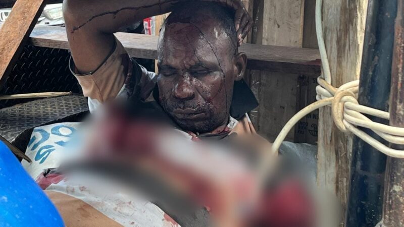 Satu Warga Tewas, Empat Lainnya Luka Akibat Penembakan KKB