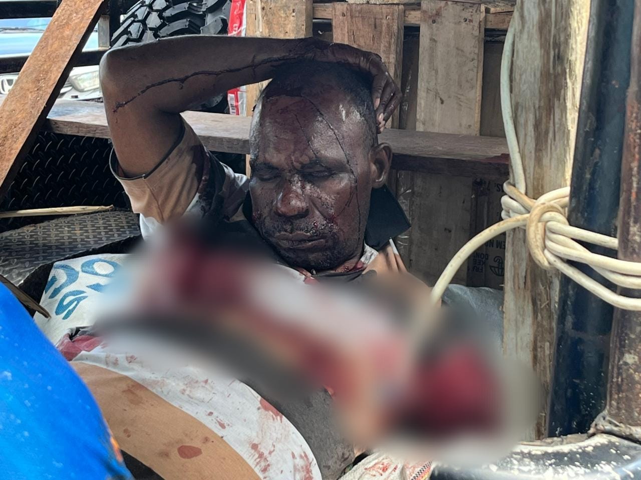 Satu Warga Tewas, Empat Lainnya Luka Akibat Penembakan KKB