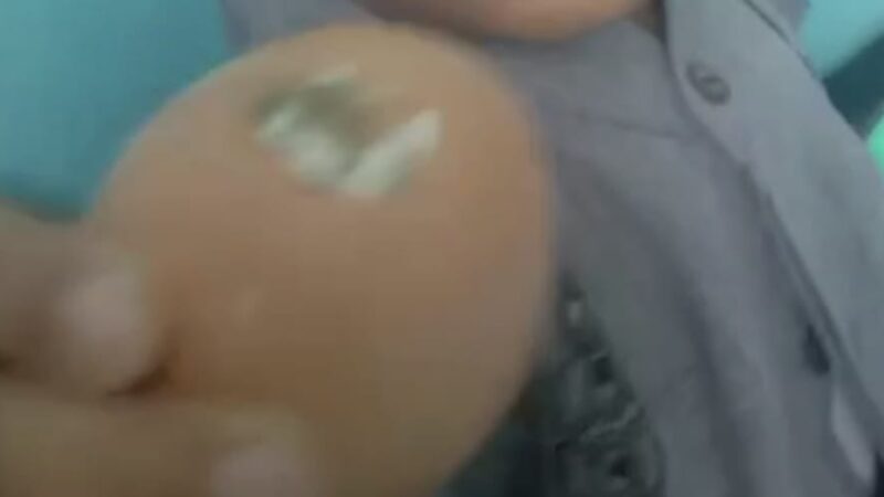 Makanan MBG Ada Kotoran Ayam Di telor, Izin S L H S dan Kehigienisan Disalah Satu MBG Di Padaherang Dipertanyakan.