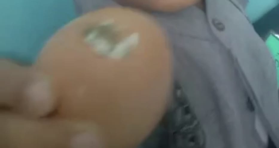 Makanan MBG Ada Kotoran Ayam Di telor, Izin S L H S dan Kehigienisan Disalah Satu MBG Di Padaherang Dipertanyakan.