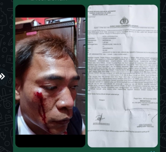 KETUA DPW IWO I SUM-SEL KECAM KERAS PENGANIAYAAN BENDAHARA DPD IWO I KOTA PAGAR ALAM OLEH KONTRAKTOR LOKAL “RL”