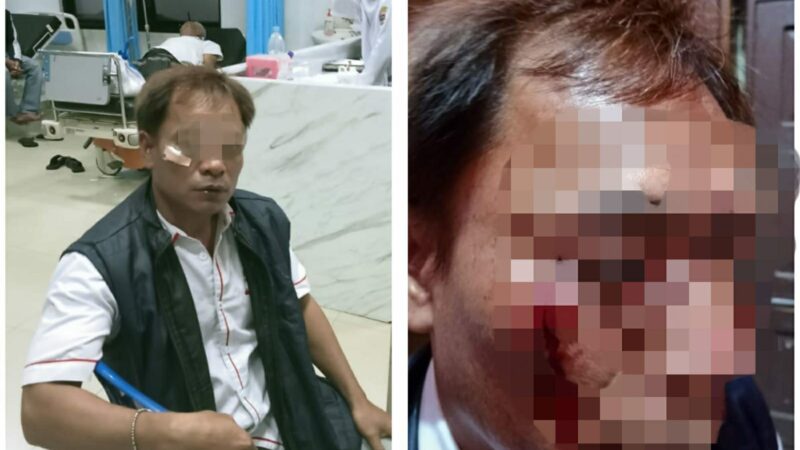 Arogansi Oknum Kontraktor: Wartawan Jadi Korban Pemukulan”