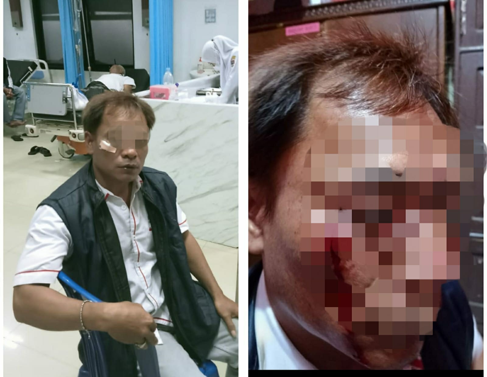 Arogansi Oknum Kontraktor: Wartawan Jadi Korban Pemukulan”