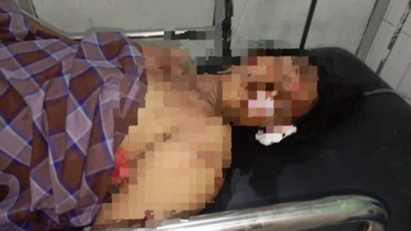 Pedagang petasan Ditusuk OTK di Ambon