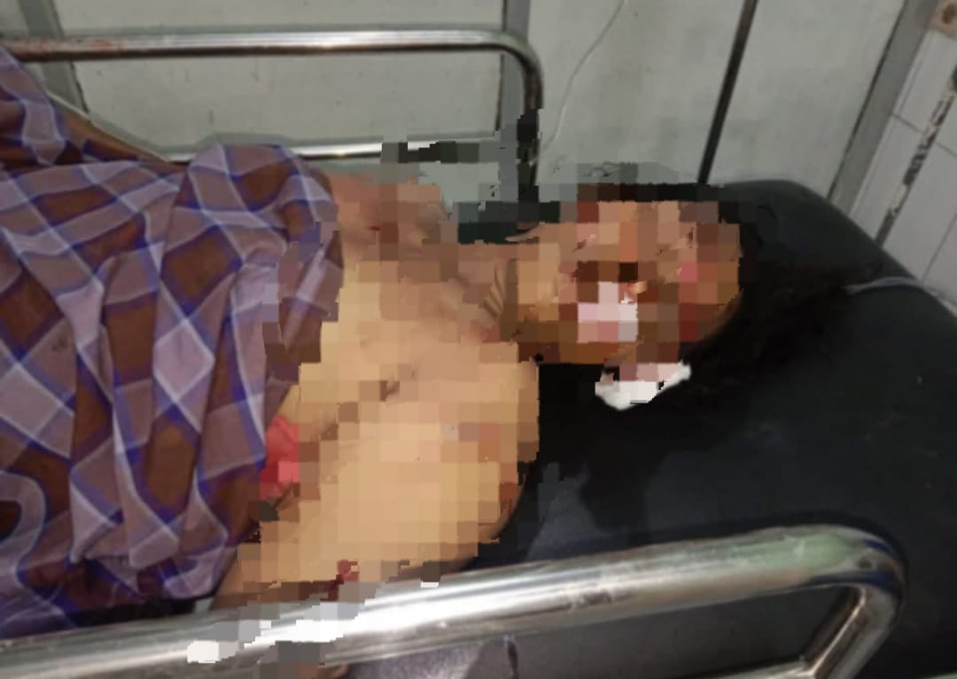 Pedagang petasan Ditusuk OTK di Ambon